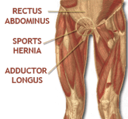 Sports-Hernia-Anatomy